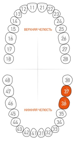 Кламп удерживающий для повязок и ватных ролов Dentech (Япония) G2